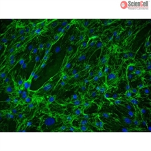 Human Mammary Fibroblasts