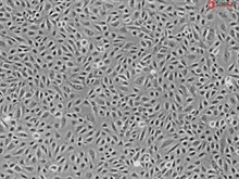 Human Umbilical Vein Endothelial Cells, Passage 1