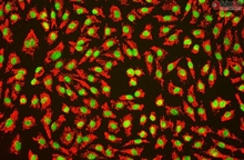 Human Umbilical Vein Endothelial Cells, Passage 1