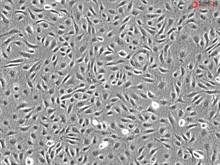 Human Umbilical Artery Endothelial Cells, Passage 1