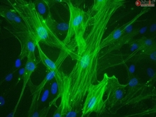 Human Umbilical Vein Smooth Muscle Cells, Passage 1