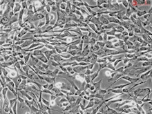 Human Umbilical Artery Smooth Muscle Cells, Passage 1