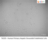 Human Primary Hepatic Sinusoidal Endothelial Cells