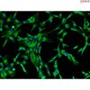 <strong>NEW!</strong> Bovine Lens Epithelial Cells