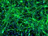 H9-derived Neural Stem Cells