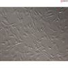 Human Coronary Artery Smooth Muscle Cells