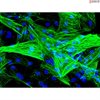 Human Coronary Artery Smooth Muscle Cells