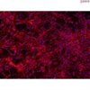 Human Dermal Fibroblasts-GFP