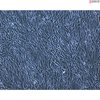 Human Dermal Fibroblasts-GFP