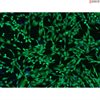 Human Dermal Fibroblasts-GFP