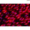 Human Gallbladder Vascular Endothelial Cells