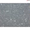 Human Gallbladder Vascular Endothelial Cells