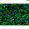 Human Gallbladder Vascular Endothelial Cells