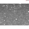 Human Mesenteric Fibroblasts (HMeF) 