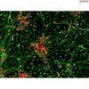 Human Pluripotent Stem Cell Derived-Cortical Neurons