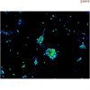 <b>NEW!</b> Human Pluripotent Stem Cell Derived-Motor Neurons
