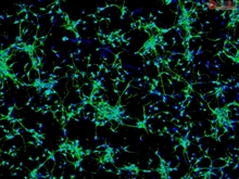 Mouse Neurons-raphe from CD1