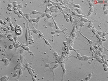Mouse Neurons-cortical from CD1