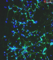 Mouse Neurons-cortical from CD1