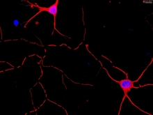 Mouse Neurons-cortical from CD1
