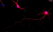 CD1 Mouse Cerebellar Granule Cells