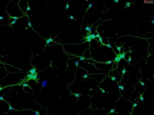 Mouse Neurons-hippocampal from CD1