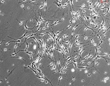 Mouse Neurons-striatal from CD1