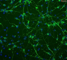 Mouse Neurons-dorsal spinal cord from C57BL/6