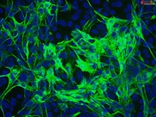 Mouse Astrocytes-hippocampal from C57BL/6