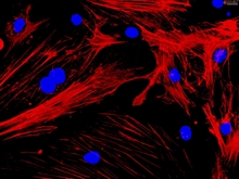 Mouse Cardiac Myocytes from CD1