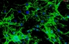 Mouse Cardiac Fibroblasts from C57BL/6