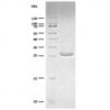 Recombinant yeast SUMO Protease