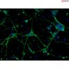 <strong>NEW!</strong> Mouse Neurons-forebrain from C57BL/6