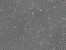 Rat Brain Microvascular Endothelial Cells