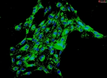 Rat Brain Microvascular Endothelial Cells