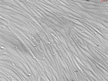 Rat Brain Microvascular Endothelial Cells