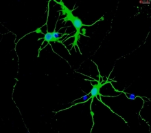 Rat Neurons-cortical