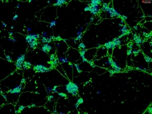 Rat Cerebellar Granule Cells