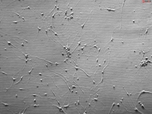 Rat Neurons-hippocampal