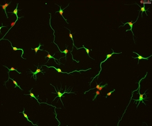 Rat Neurons-hippocampal