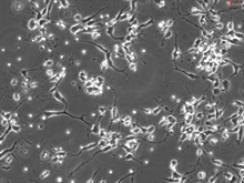 Rat Neurons-substantia nigra