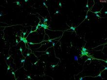 Rat Neurons-substantia nigra