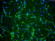 Rat Neurons-striatal