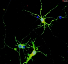 Rat Neurons-striatal