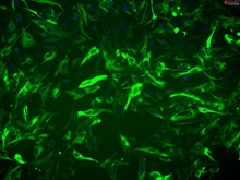 Rat Astrocytes-cerebellar, GFAP positive