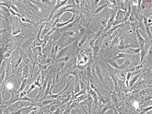 Rat Pulmonary Fibroblasts