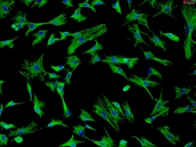 Rat Pulmonary Fibroblasts