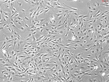 Rat Hepatic Stellate Cells