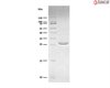 Recombinant yeast SUMO Protease