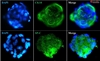 3D Human Primary Pulmonary Alveolar Epithelial Cell Spheroids